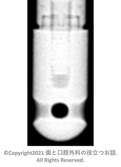 Spline Cylinder MP-1
