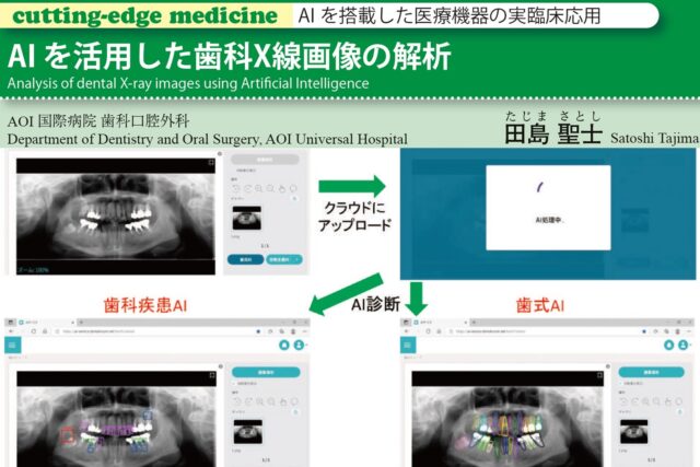 AIを搭載した医療機器の臨床応用