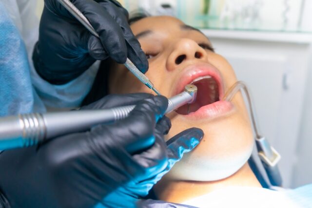 歯科と口腔外科の豆知識