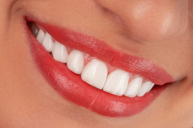 ブラックフィルム